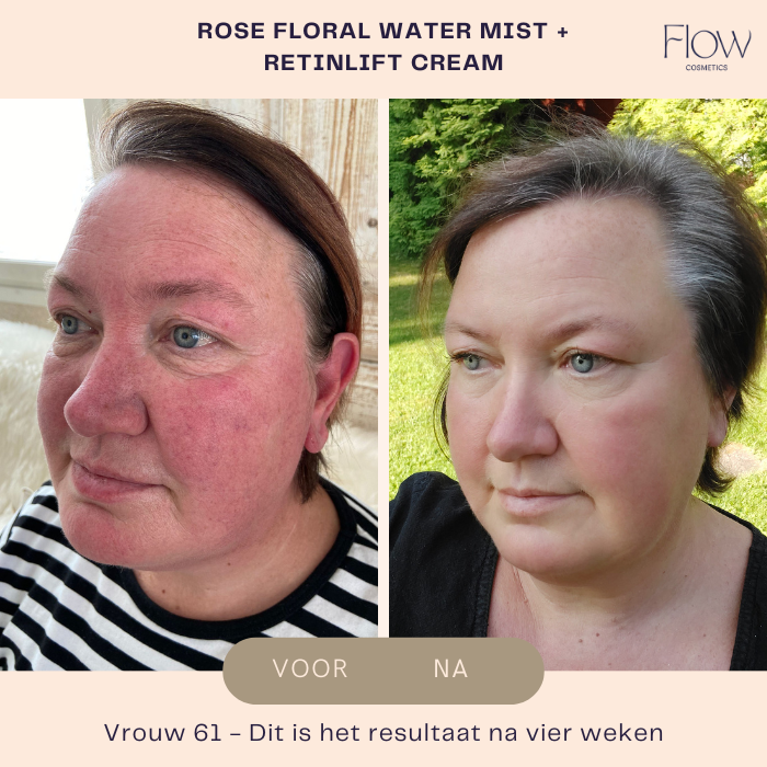 RetinLift 3-in-1 - Retinol Creme - Flow Cosmetics - 50ml